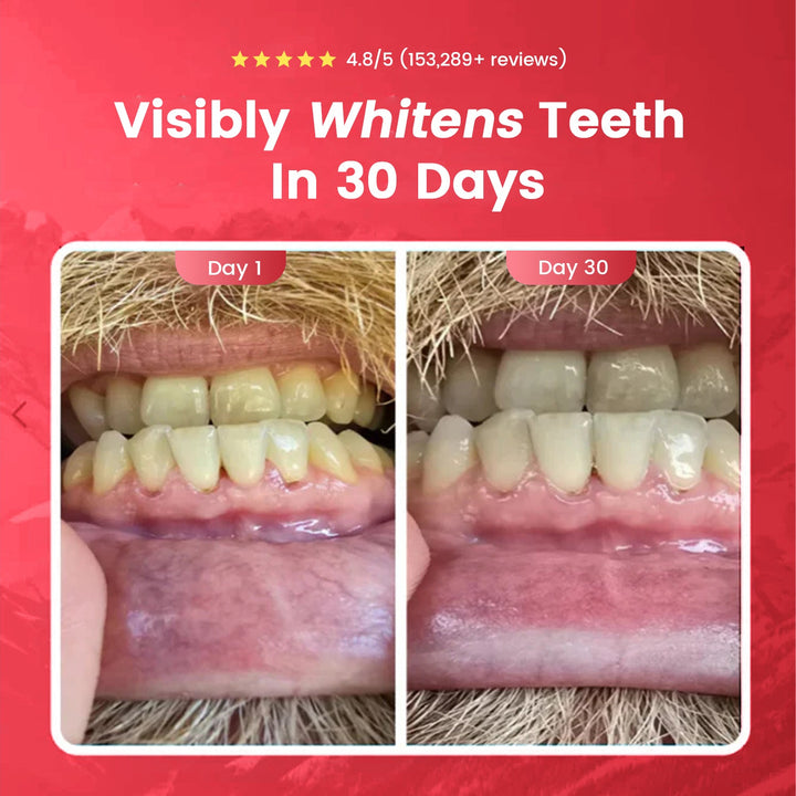 Lumiva™ – Probiotic Whitening Toothpaste with 10% Nano-Hydroxyapatite &amp; 8 Live Strains + 50% OFF
