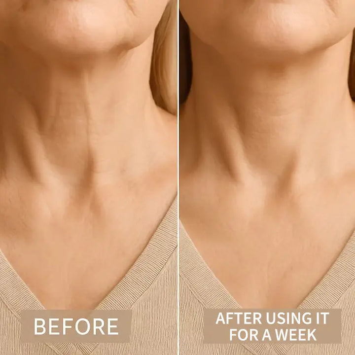 Tautelle™ – Invisible Lifting Tape for Neck Wrinkles &amp; Sagging Skin + 1+1 FREE